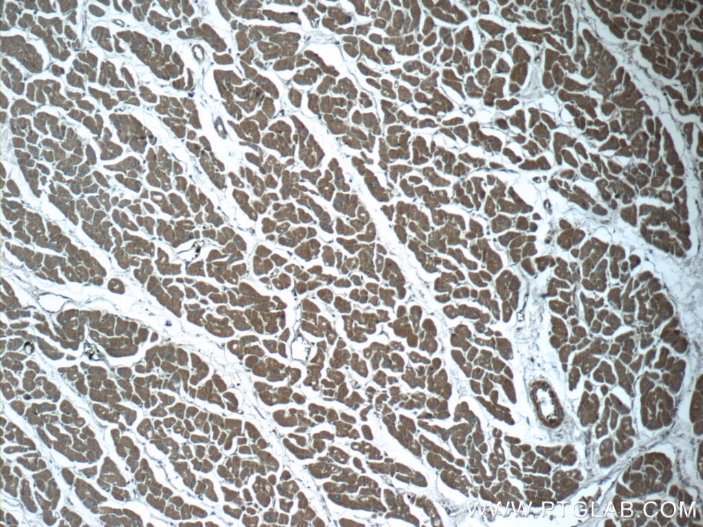 Immunohistochemistry (IHC) staining of human heart tissue using RPGR Polyclonal antibody (16891-1-AP)