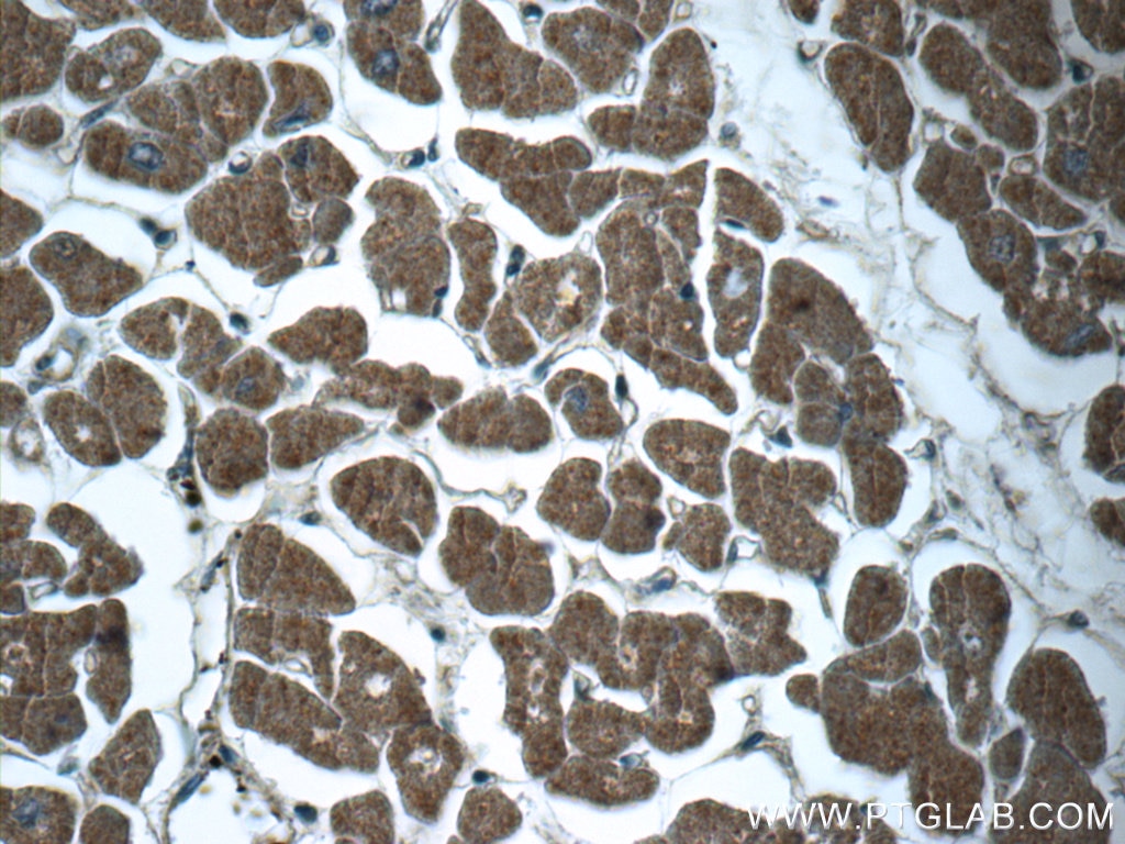 Immunohistochemistry (IHC) staining of human heart tissue using RPGR Polyclonal antibody (16891-1-AP)