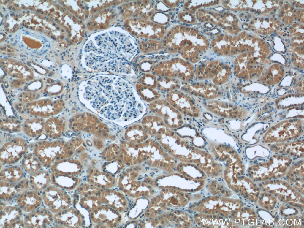 Immunohistochemistry (IHC) staining of human kidney tissue using RPGR Polyclonal antibody (16891-1-AP)