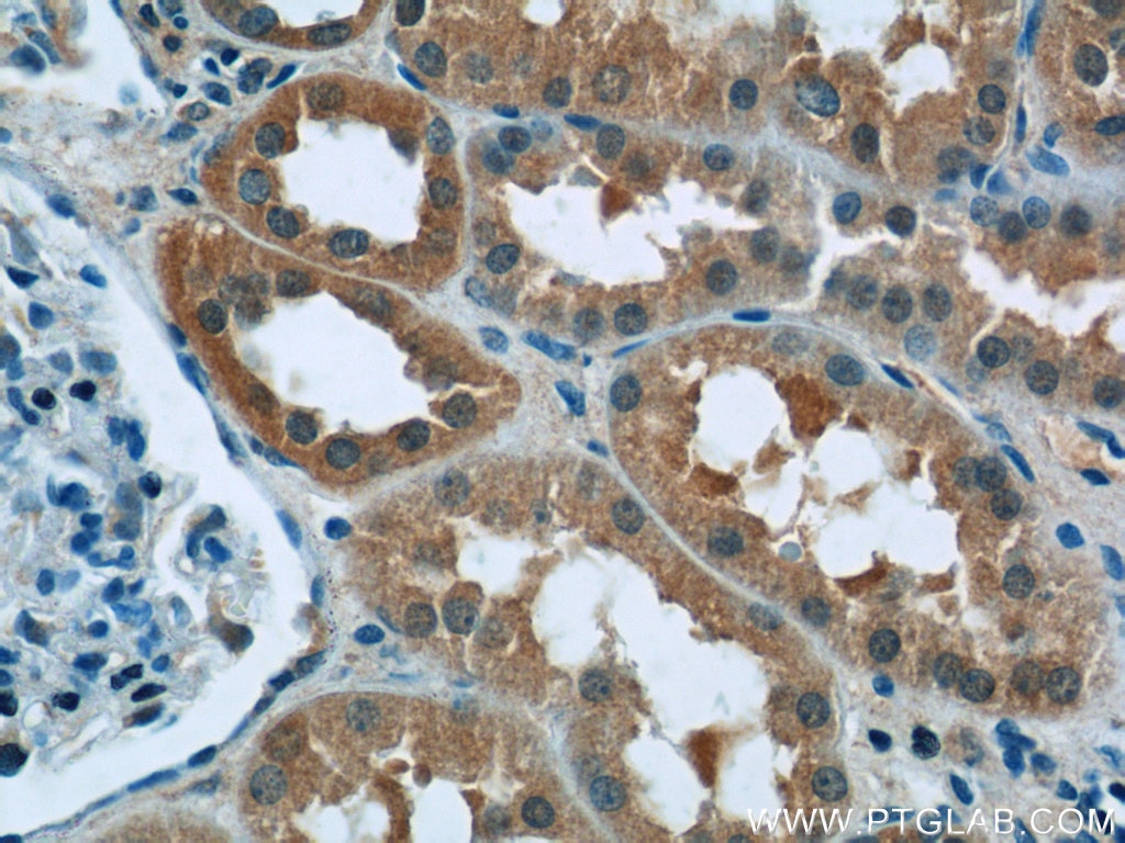 Immunohistochemistry (IHC) staining of human kidney tissue using RPGR Polyclonal antibody (16891-1-AP)