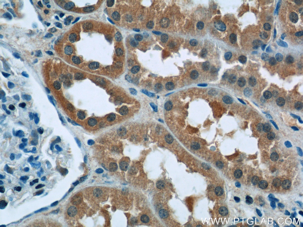 IHC staining of human kidney using 16891-1-AP