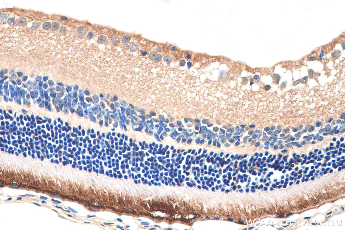 Immunohistochemistry (IHC) staining of mouse eye tissue using RPGR Polyclonal antibody (16891-1-AP)