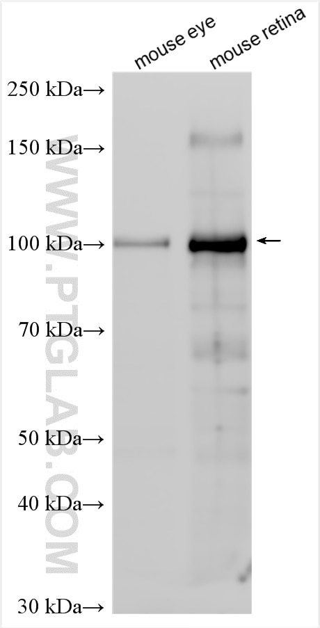 Western Blot (WB) analysis of various lysates using RPGR Polyclonal antibody (16891-1-AP)