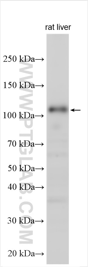 Western Blot (WB) analysis of various lysates using RPGR Polyclonal antibody (16891-1-AP)
