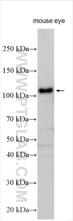 Western Blot (WB) analysis of various lysates using RPGR Polyclonal antibody (16891-1-AP)
