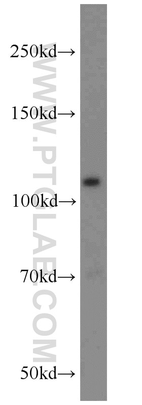 Western Blot (WB) analysis of mouse liver tissue using RPGR Polyclonal antibody (16891-1-AP)