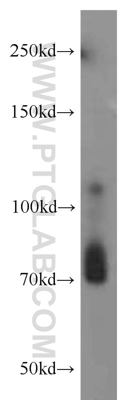 Western Blot (WB) analysis of Y79 cells using RPGR Polyclonal antibody (16891-1-AP)