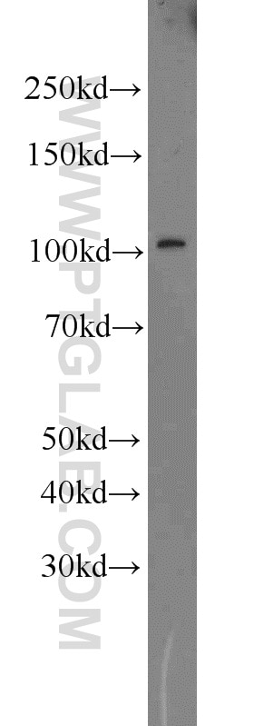 Western Blot (WB) analysis of mouse eye tissue using RPGR Polyclonal antibody (16891-1-AP)