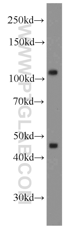 WB analysis of SH-SY5Y using 16891-1-AP