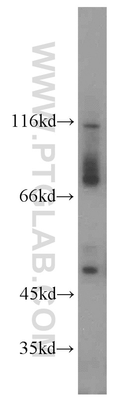 Western Blot (WB) analysis of SH-SY5Y cells using RPGR Polyclonal antibody (16891-1-AP)