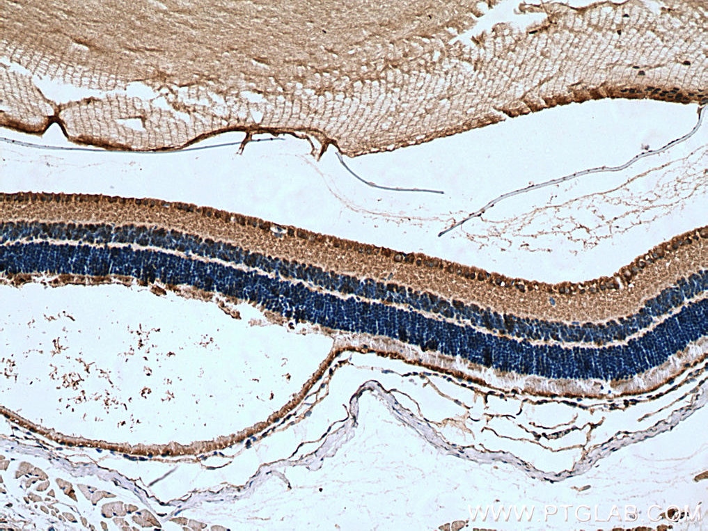 Immunohistochemistry (IHC) staining of mouse eye tissue using RPGRIP1 Polyclonal antibody (13214-1-AP)