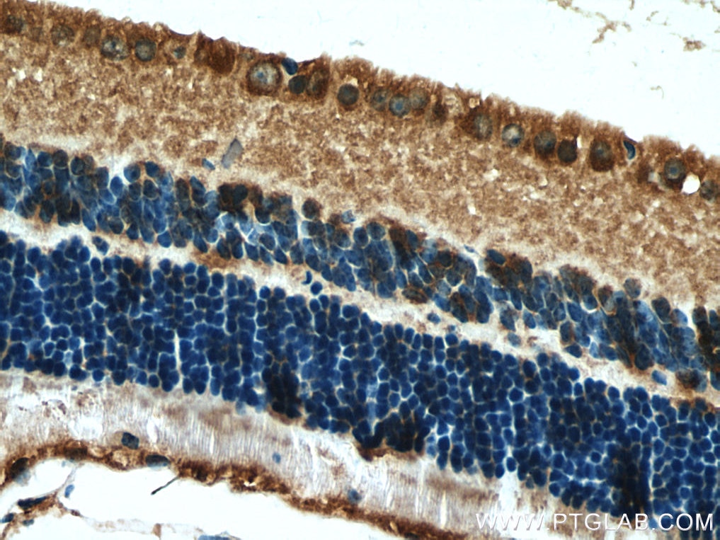 Immunohistochemistry (IHC) staining of mouse eye tissue using RPGRIP1 Polyclonal antibody (13214-1-AP)