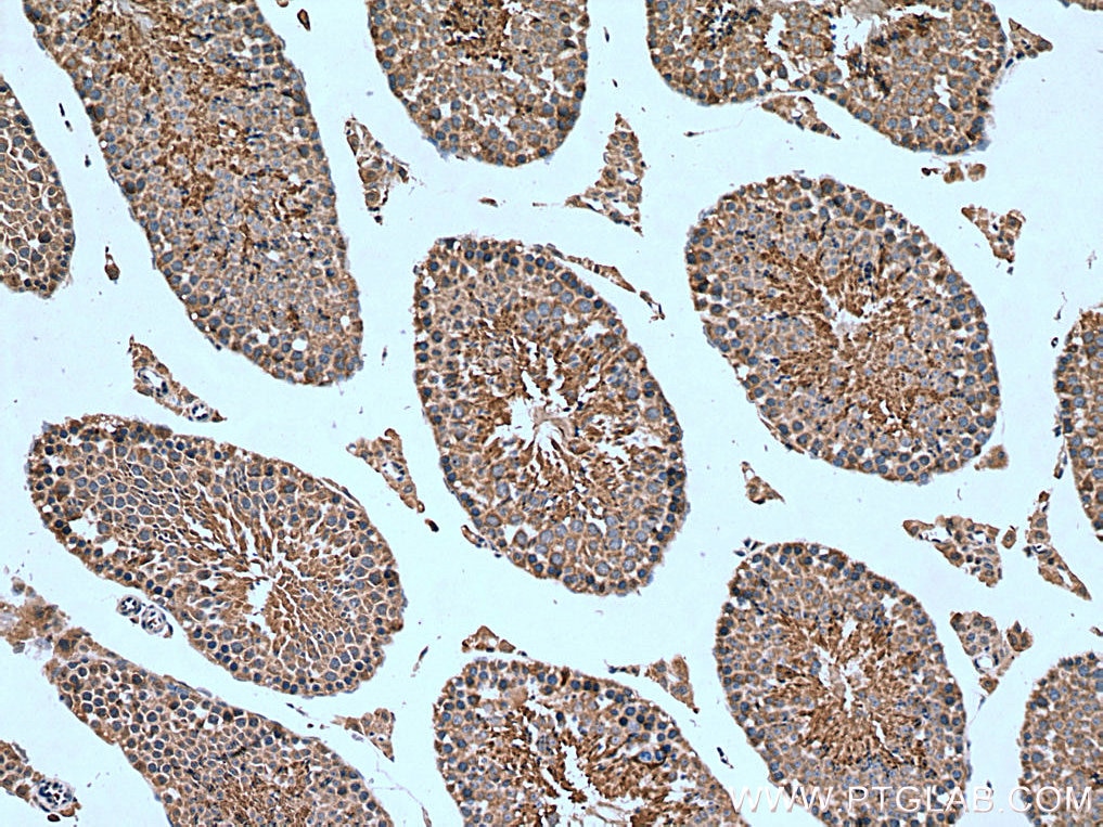 Immunohistochemistry (IHC) staining of mouse testis tissue using RPGRIP1 Polyclonal antibody (13214-1-AP)