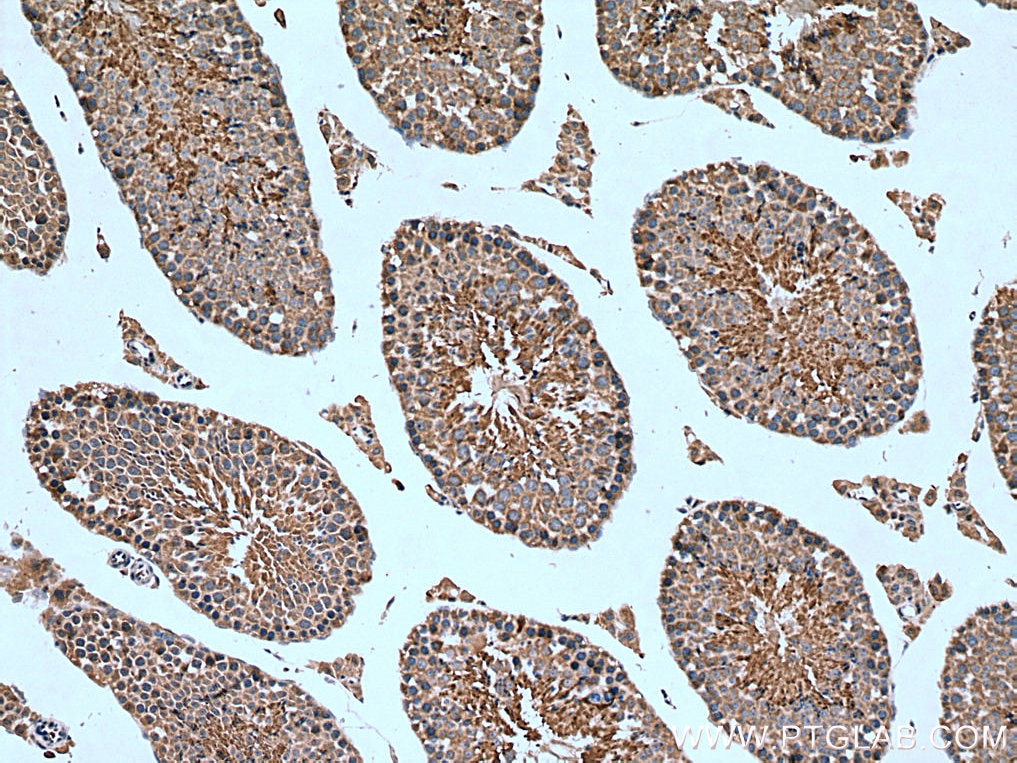 IHC staining of mouse testis using 13214-1-AP