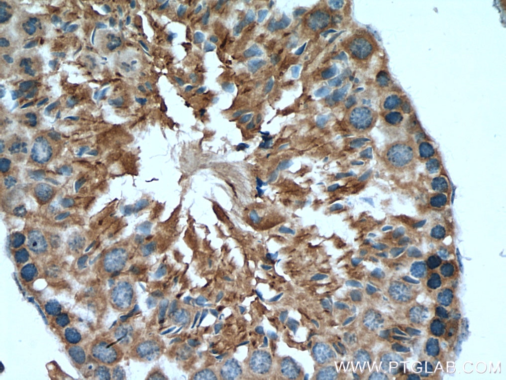 IHC staining of mouse testis using 13214-1-AP