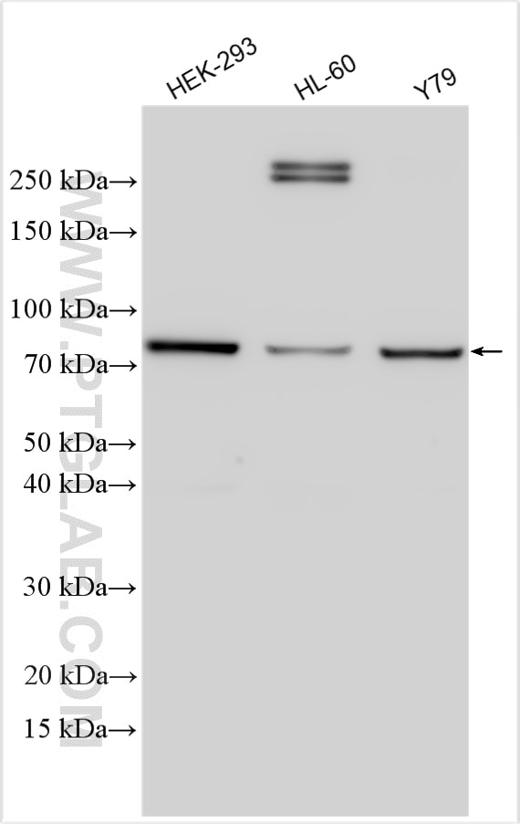 Western Blot (WB) analysis of various lysates using RPGRIP1 Polyclonal antibody (13214-1-AP)