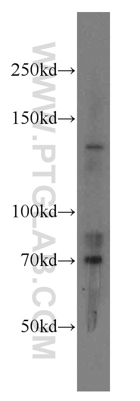RPGRIP1 Polyclonal antibody