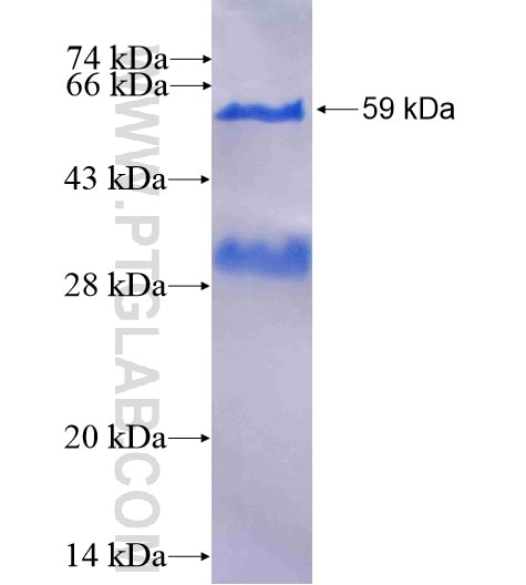 RPGRIP1 fusion protein Ag4089 SDS-PAGE