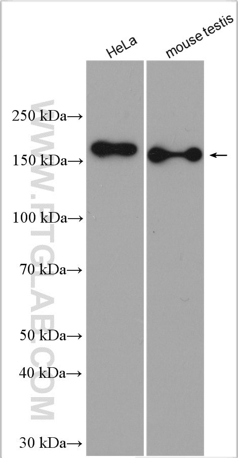 Western Blot (WB) analysis of various lysates using RPGRIP1L Polyclonal antibody (29778-1-AP)