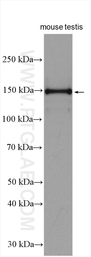 Western Blot (WB) analysis of mouse testis tissue using RPGRIP1L Polyclonal antibody (29778-1-AP)