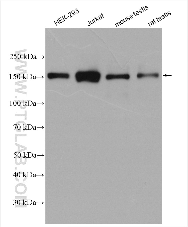 Western Blot (WB) analysis of various lysates using RPGRIP1L Polyclonal antibody (29778-1-AP)