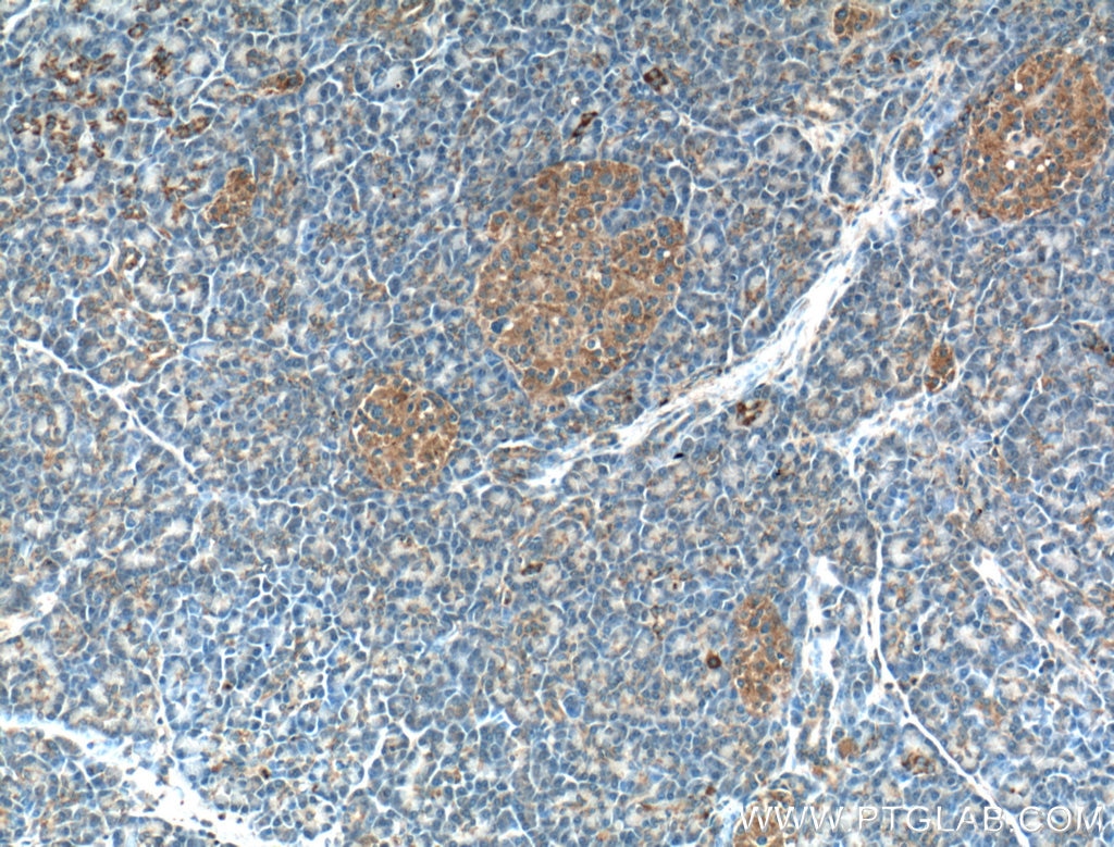 Immunohistochemistry (IHC) staining of human pancreas tissue using RPGRIP1L Polyclonal antibody (55160-1-AP)