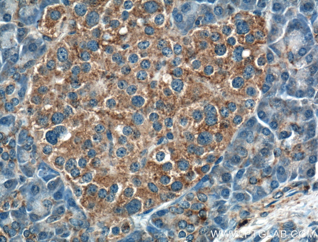 Immunohistochemistry (IHC) staining of human pancreas tissue using RPGRIP1L Polyclonal antibody (55160-1-AP)