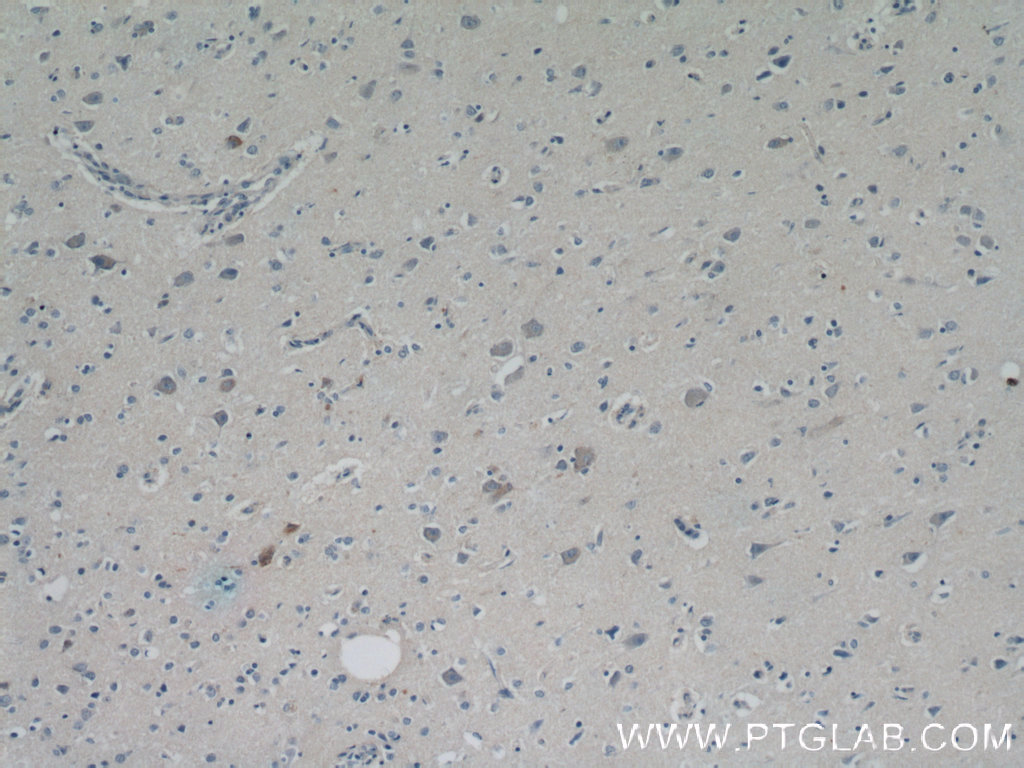 Immunohistochemistry (IHC) staining of human brain tissue using RPGRIP1L Polyclonal antibody (55160-1-AP)