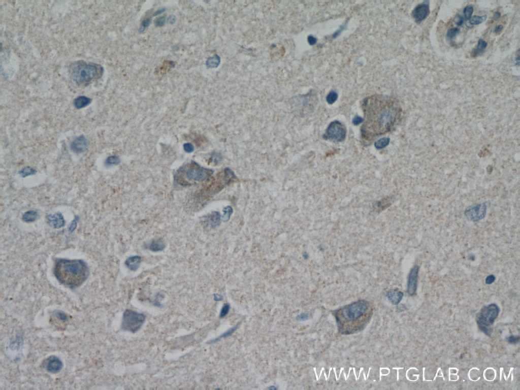 Immunohistochemistry (IHC) staining of human brain tissue using RPGRIP1L Polyclonal antibody (55160-1-AP)