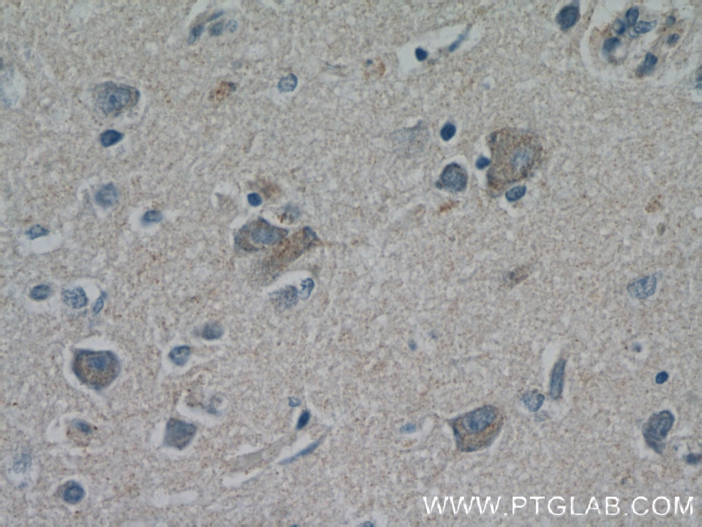 IHC staining of human brain using 55160-1-AP