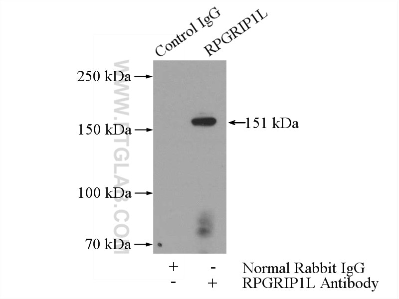 Immunoprecipitation (IP) experiment of HEK-293 cells using RPGRIP1L Polyclonal antibody (55160-1-AP)