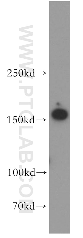 Western Blot (WB) analysis of HEK-293 cells using RPGRIP1L Polyclonal antibody (55160-1-AP)