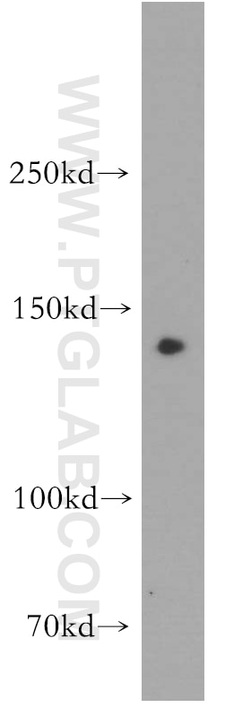 WB analysis of human kidney using 55160-1-AP