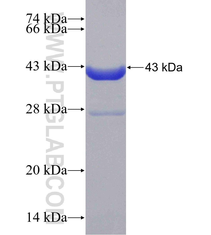 RPGRIP1L fusion protein Ag31168 SDS-PAGE