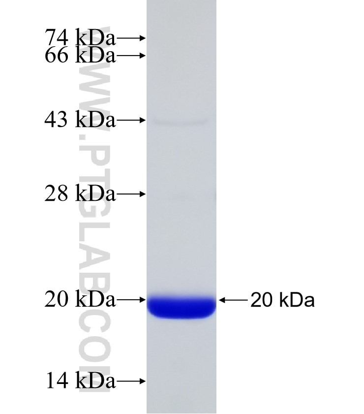RPGRIP1L fusion protein Ag31171 SDS-PAGE