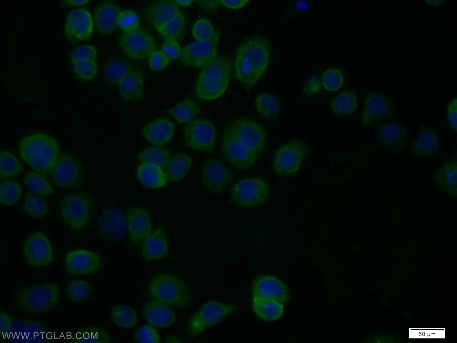 Immunofluorescence (IF) / fluorescent staining of COLO 320 cells using RPH3A Polyclonal antibody (11396-1-AP)