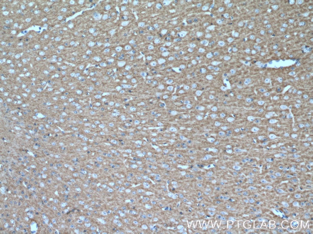 Immunohistochemistry (IHC) staining of mouse brain tissue using RPH3A Polyclonal antibody (11396-1-AP)