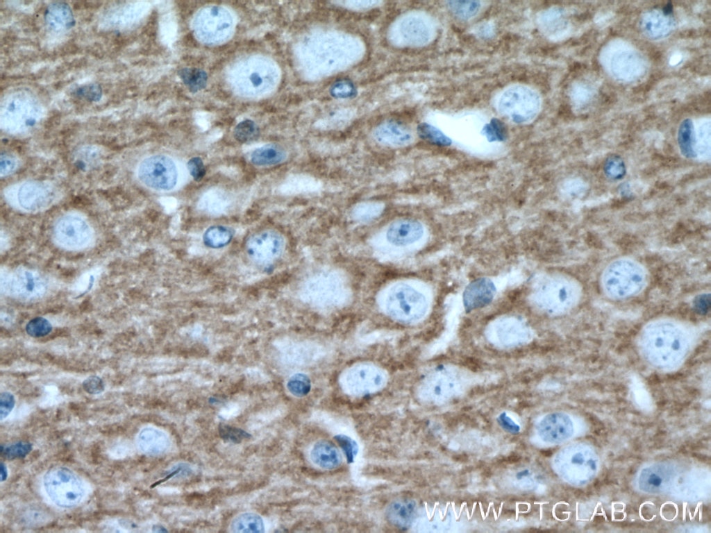 Immunohistochemistry (IHC) staining of mouse brain tissue using RPH3A Polyclonal antibody (11396-1-AP)