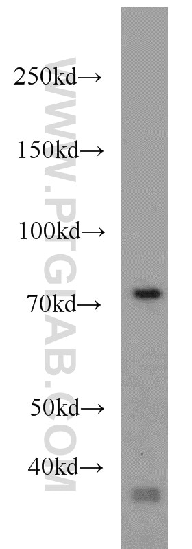 Western Blot (WB) analysis of human brain tissue using RPH3A Polyclonal antibody (11396-1-AP)