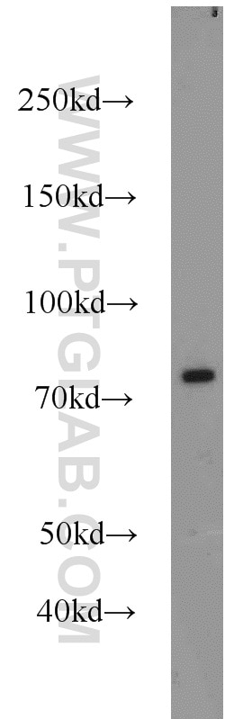 Western Blot (WB) analysis of COLO 320 cells using RPH3A Polyclonal antibody (11396-1-AP)