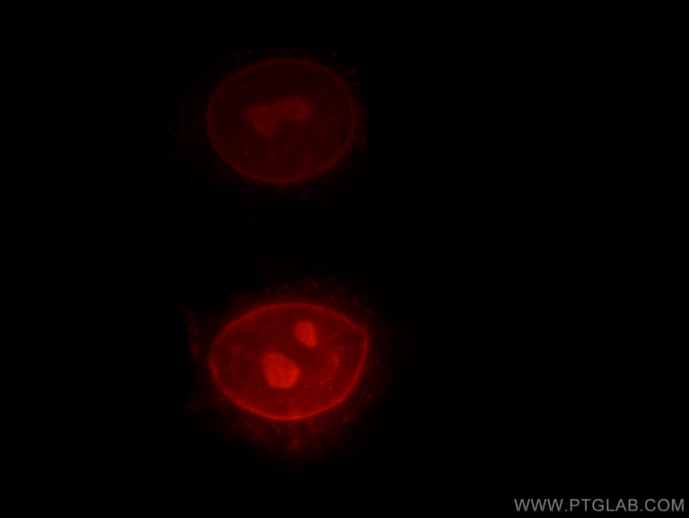 Immunofluorescence (IF) / fluorescent staining of HepG2 cells using RPIA Polyclonal antibody (13010-1-AP)