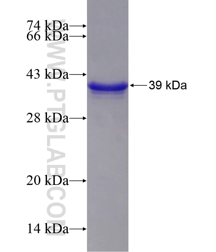 RPIA fusion protein Ag14593 SDS-PAGE