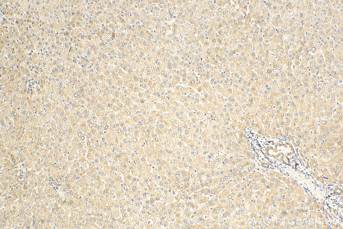 Immunohistochemistry (IHC) staining of human liver tissue using RPL10 Polyclonal antibody (17013-1-AP)