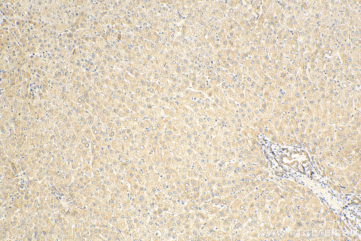 IHC staining of human liver using 17013-1-AP