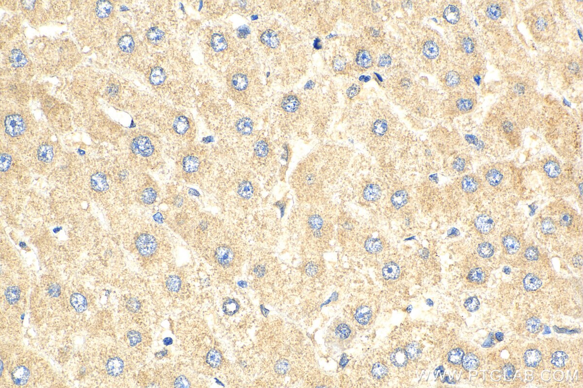 Immunohistochemistry (IHC) staining of human liver tissue using RPL10 Polyclonal antibody (17013-1-AP)