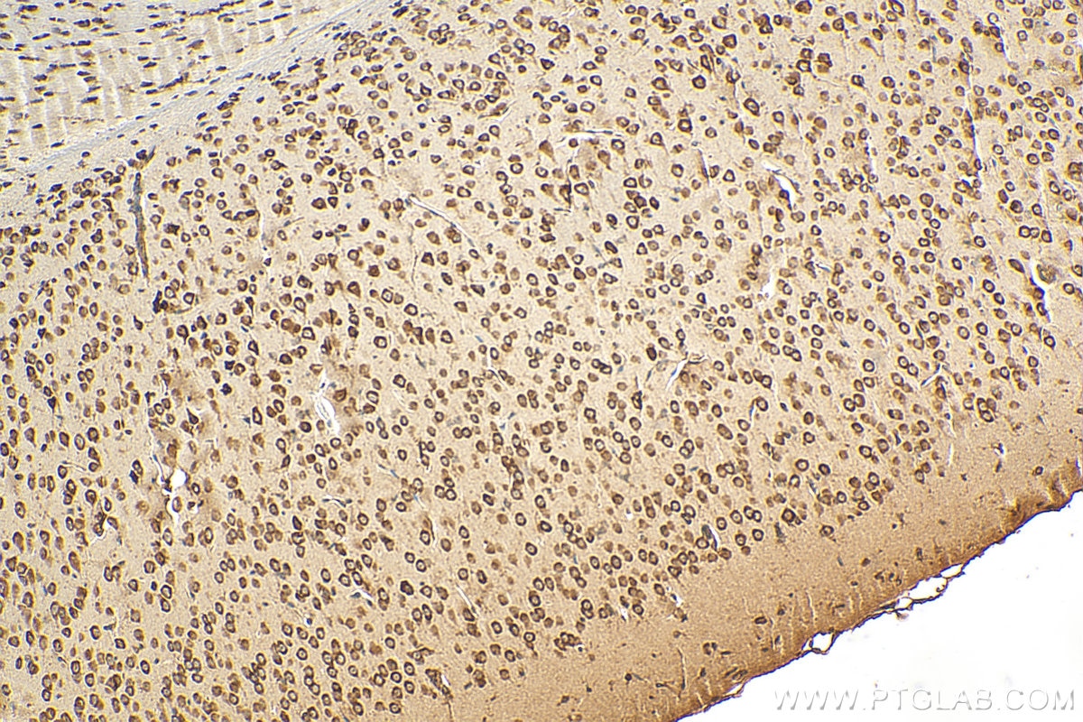 Immunohistochemistry (IHC) staining of mouse brain tissue using RPL10 Polyclonal antibody (17013-1-AP)