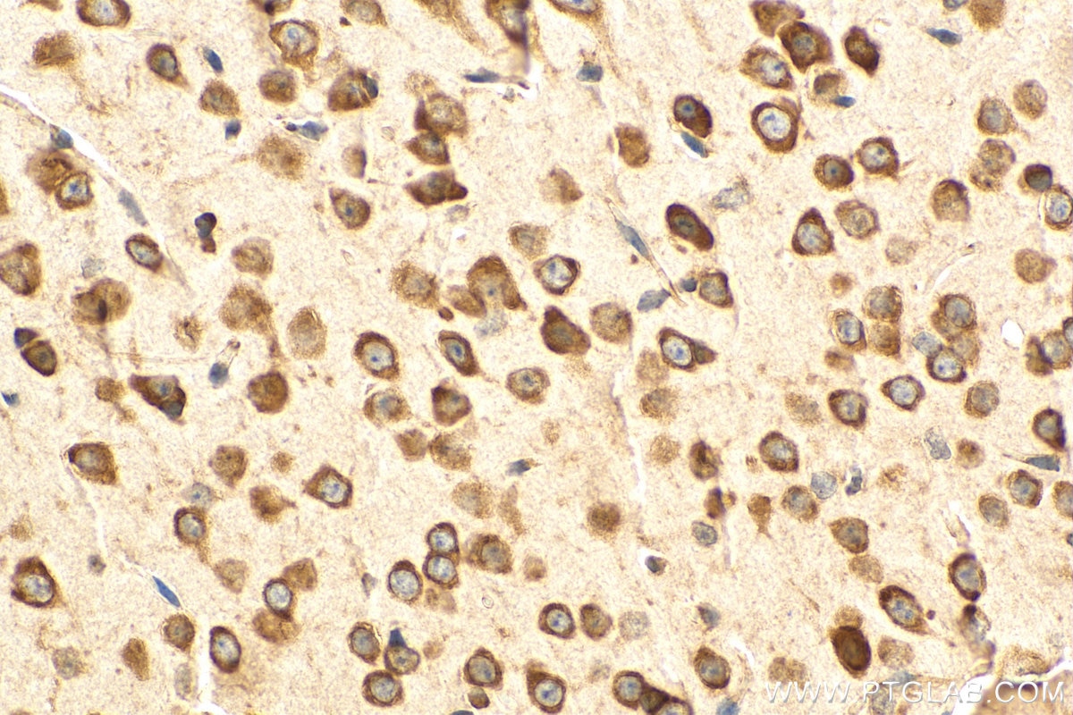 Immunohistochemistry (IHC) staining of mouse brain tissue using RPL10 Polyclonal antibody (17013-1-AP)