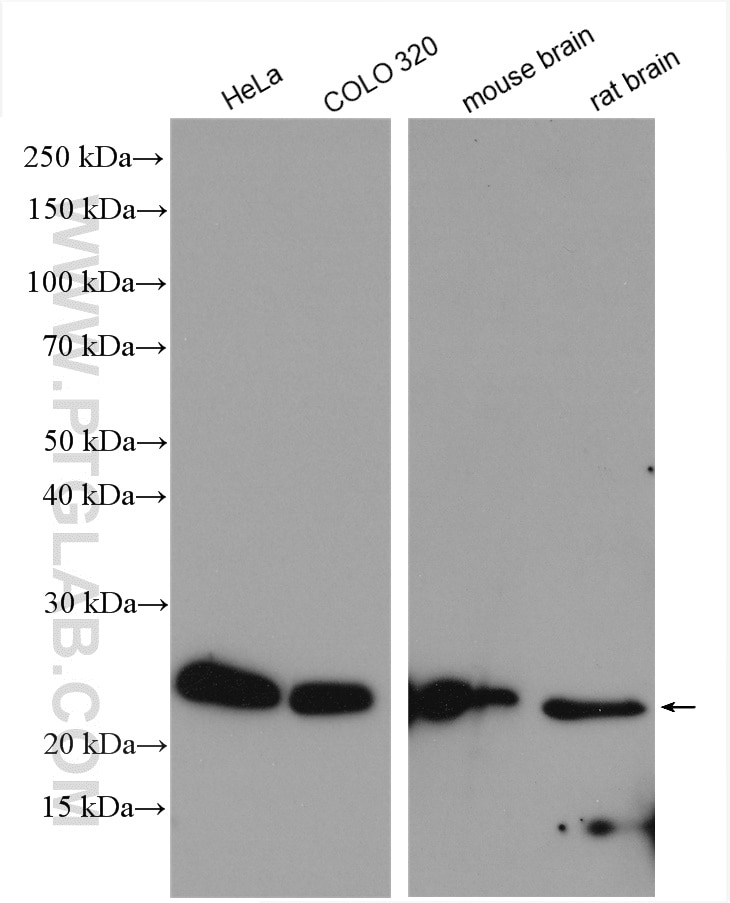 Western Blot (WB) analysis of various lysates using RPL10 Polyclonal antibody (17013-1-AP)