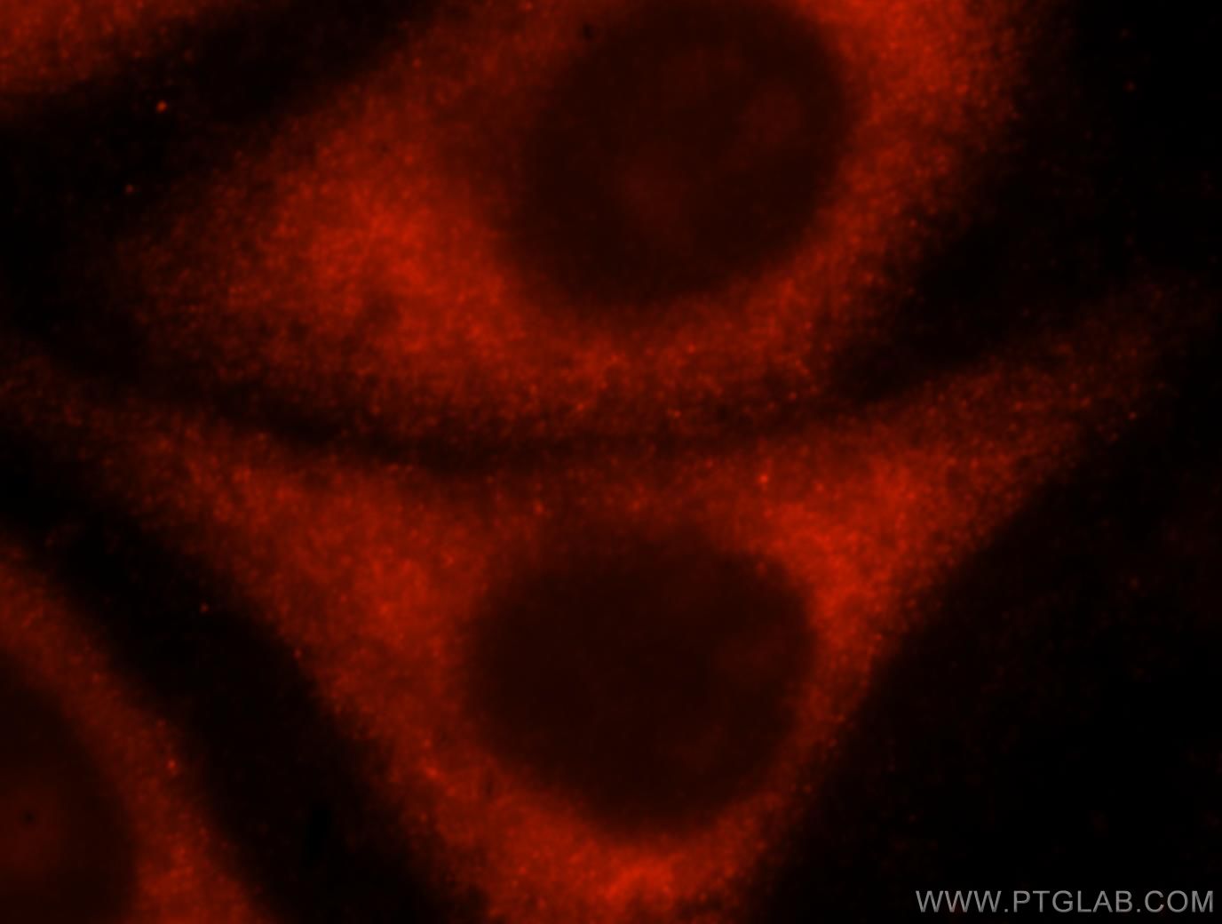 Immunofluorescence (IF) / fluorescent staining of HepG2 cells using RPL10A Polyclonal antibody (16681-1-AP)