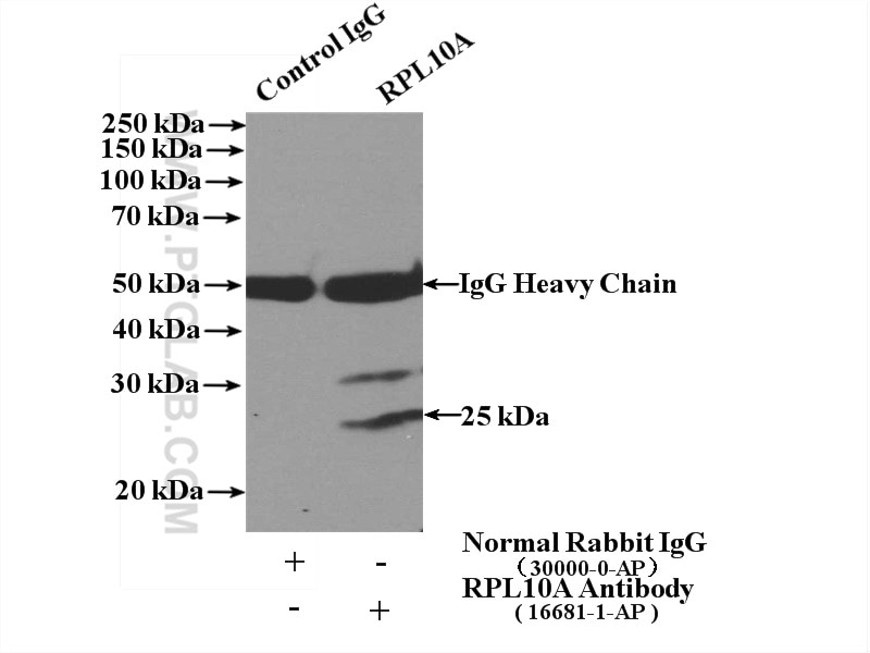 Immunoprecipitation (IP) experiment of HeLa cells using RPL10A Polyclonal antibody (16681-1-AP)